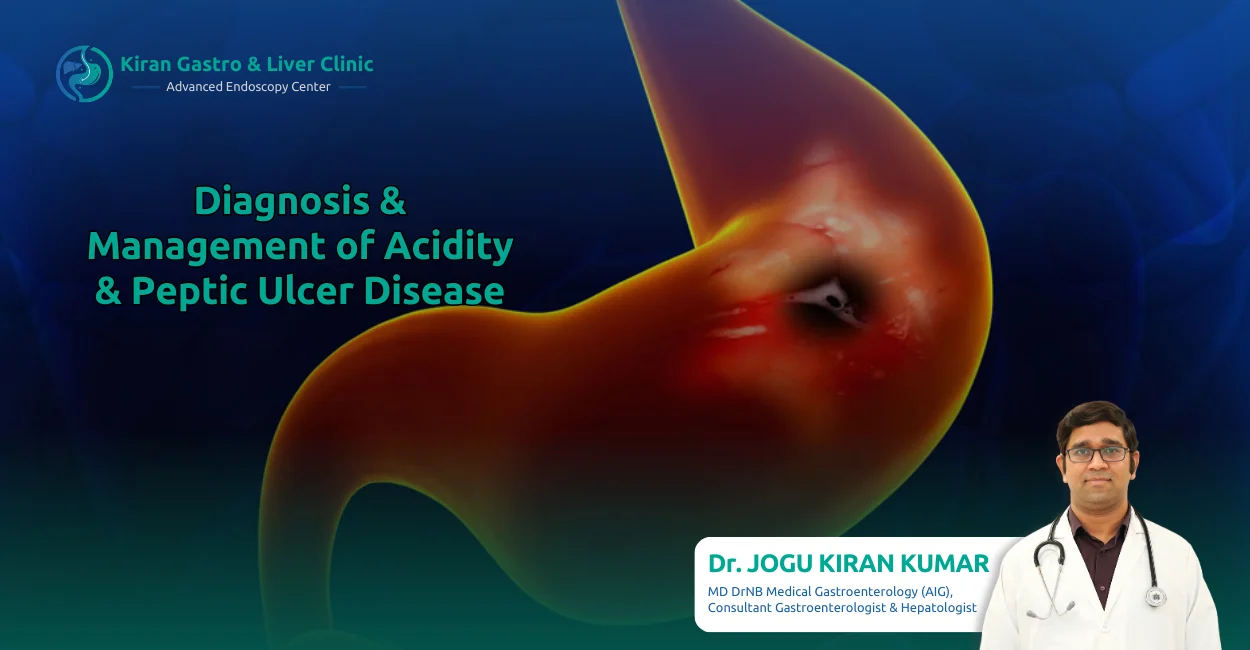 Diagnosis & Management of Acidity & Peptic Ulcer Disease - dr kiran kumar jogu